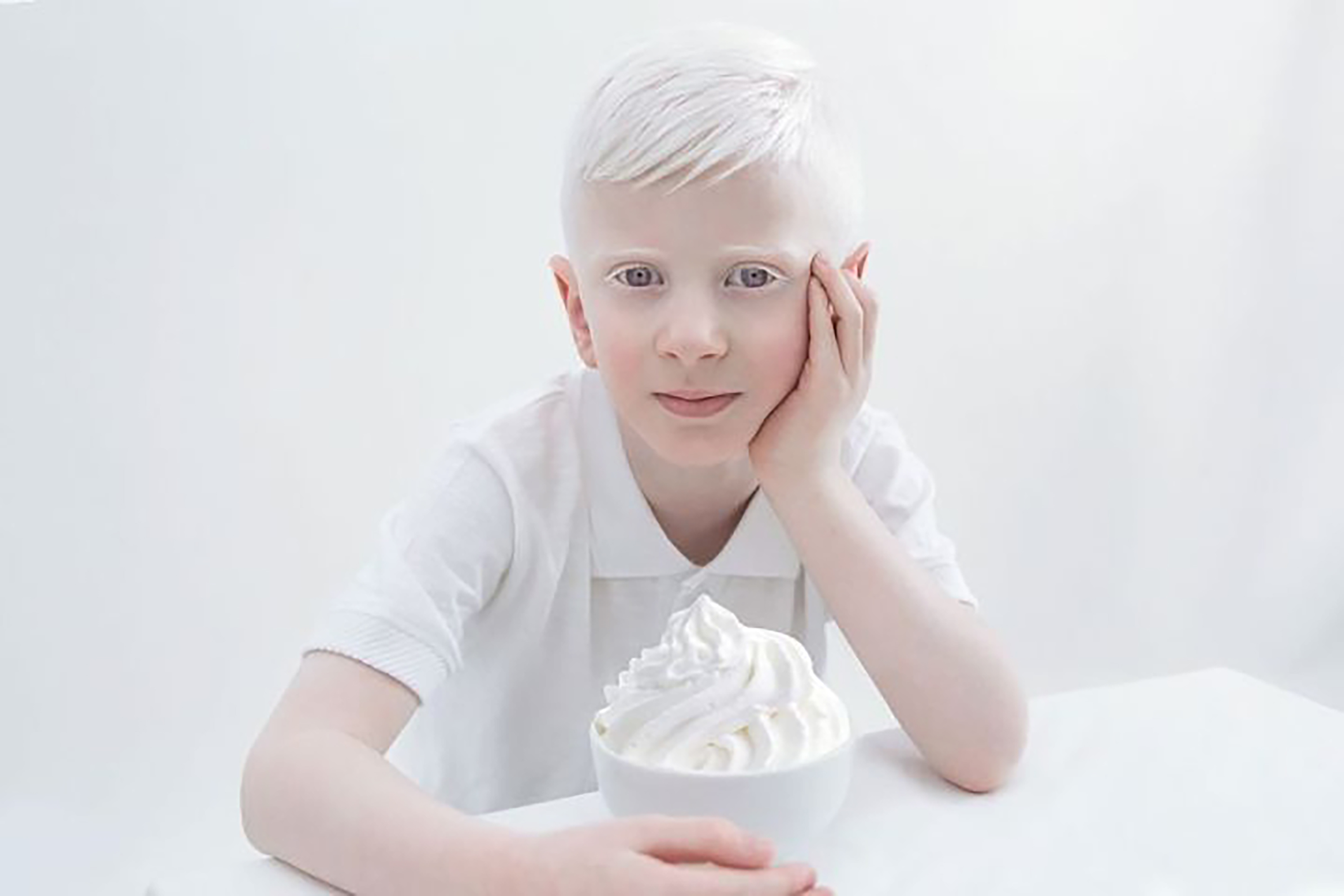 Как люди рождаются альбиносами